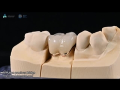 Naturalny kolor zębów Ceramic Feldspathic Veneer dla przednich i tylnych zębów