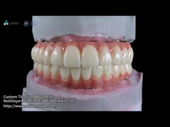Przejrzysty pełny kontur Zirconia Bridge Over Milled Implant Bar