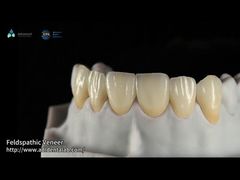 Przedstawiamy 0,3 mm-0,7 mm licówki ceramiczne Feldspathic EMAX Naturalne estetyczne licówki dentystyczne Emax dla Ciebie