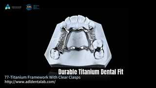 Przezroczyste klamry 3D Titanium Dental Framework