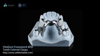 Vitallium Framework Naturalna estetyka Łatwe dopasowanie