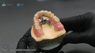 Jakość lutowania precyzyjnej korony teleskopowej