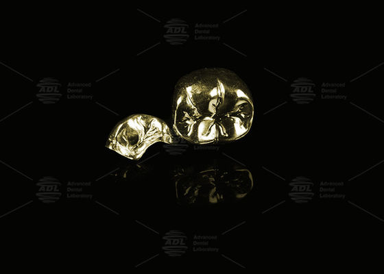 kupować Szlachetny stop Żółty złoto 60% pełna korona metalowa złoto wykończenie pełna korona metalowa produkcja online