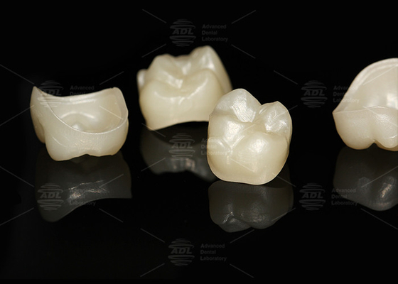 kupować Naturalny pełny kontur Zirconia Crown Precise Fit pełny kontur Dental Lab produkcja online