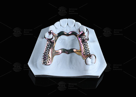 kupować Czuła skóra wysokiej wytrzymałości Titanium ramy rozwiązanie drukowane 3D produkcja online