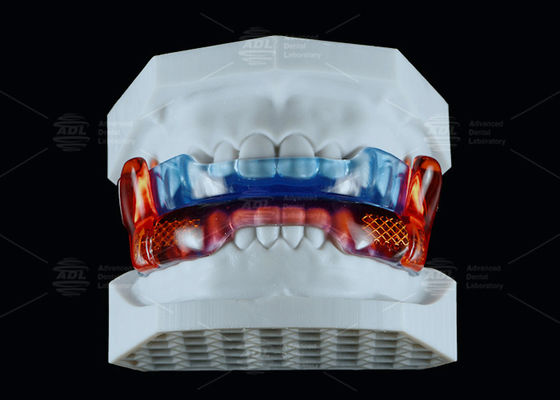 kupować Urządzenie antychrząsające z silikonu medycznego typu RP dla poprawy snu produkcja online