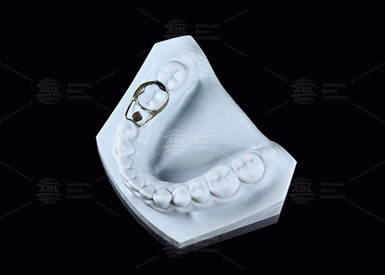 kupować SS Pediatryczny podtrzymujący przestrzeń wygodny higieniczny podtrzymujący przestrzeń dentystyczną dla dorosłych produkcja online