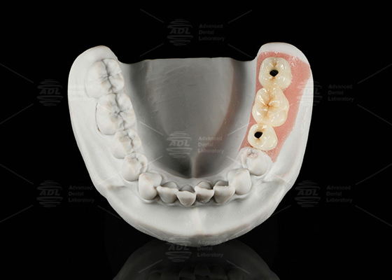 kupować Wyrobek z porcelany z titanem, wytrzymany śrubokrętem, połączony z cyrkonem produkcja online
