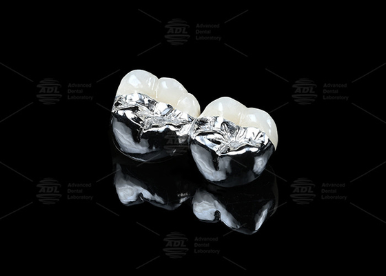 kupować Co Cr Ceramic PFM Restauracje Cad Cam Pfm Crown Naturalny wygląd produkcja online