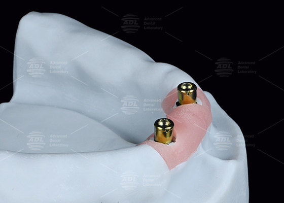 kupować Zastosowanie lokalizatora nadęcia Titanium Bracket Locator produkcja online