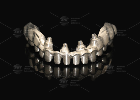 kupować Hybrydowy Różowy Implant Porcelanowy Korona Malong Całkowity Łuk Implant Most Natychmiastowe ładowanie produkcja online
