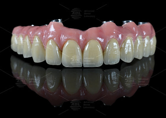 kupować China Dental Lab Hybrid Bridge Implant Bar Malong Design Screw Retained Or Cemented Metodę instalacji dla precyzyjnych aplikacji stomatologicznych produkcja online