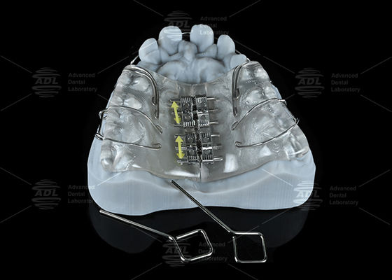kupować Kolorowy ekspander śrubowy ze stali nierdzewnej do ekspansji szczęki i żuchwy produkcja online