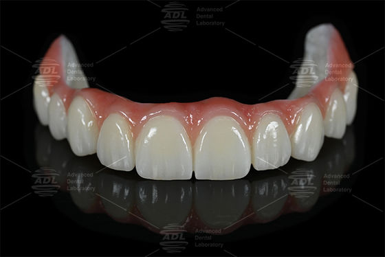 kupować China Dental Lab Titanium And Zirconia All on X w 16 odcieniach w tym A1 A2 A3 z laboratorium stomatologicznego dla naturalnej estetyki stomatologicznej produkcja online