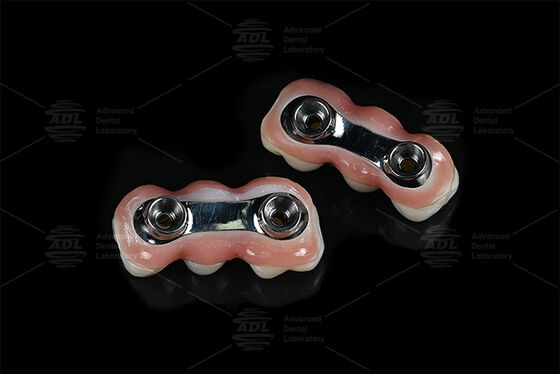 kupować Wzmocnienie Implant Bar CAD CAM Zaprojektowany do precyzyjnego dopasowania Kompatybilny z większością systemów implantów stomatologicznych Zapewniając rozwiązania odbudowy zębów Chińskie laboratorium stomatologiczne produkcja online