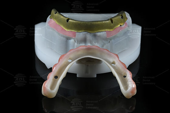 kupować Chińskie laboratorium stomatologiczne Kompatybilne z większością systemów implantów stomatologicznych Wszystkie na 4 oferowane w ciągu 72 godzin Czas realizacji i szereg parametrów technicznych produkcja online