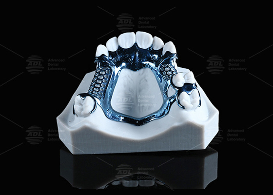 Anodyzowana, drukowana w 3D ramka z tytanu, lekka i odpowiednia dla wrażliwej skóry