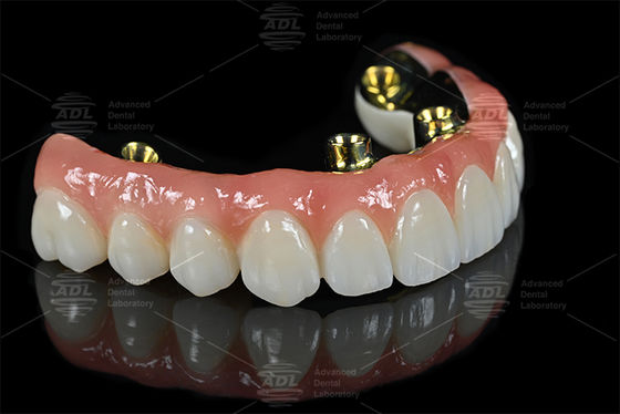 Professional Dental Lab Outsourcing Services Delivering Accurate Dental Prosthetics and Custom Solutions for Dental Industry Needs